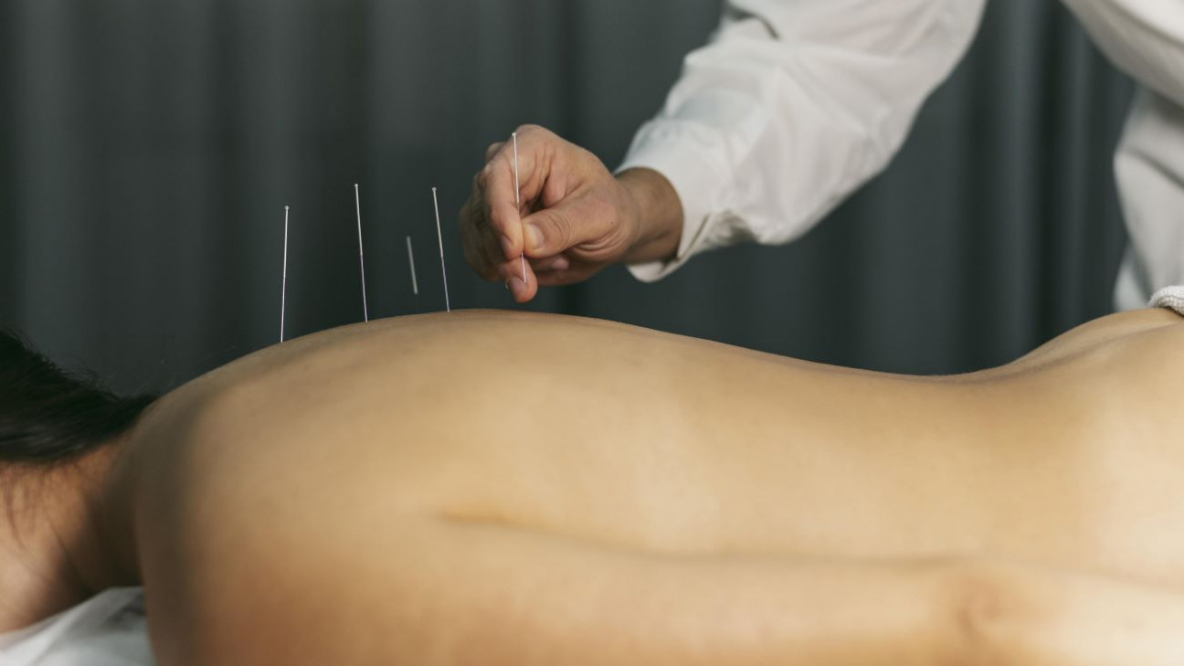 imagen Acupuntura: una terapia complementaria milenaria se suma a CUSFyC