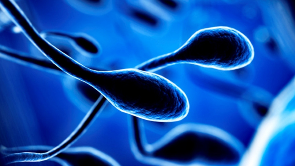imagen Defienden tesis que analiza la microdileciones del cromosoma Y en la población masculina infértil