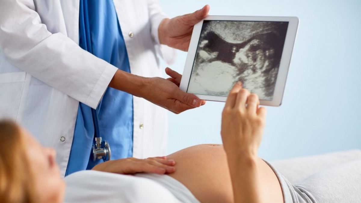 imagen Patología fetal: malformaciones del aparato digestivo y pared abdominal