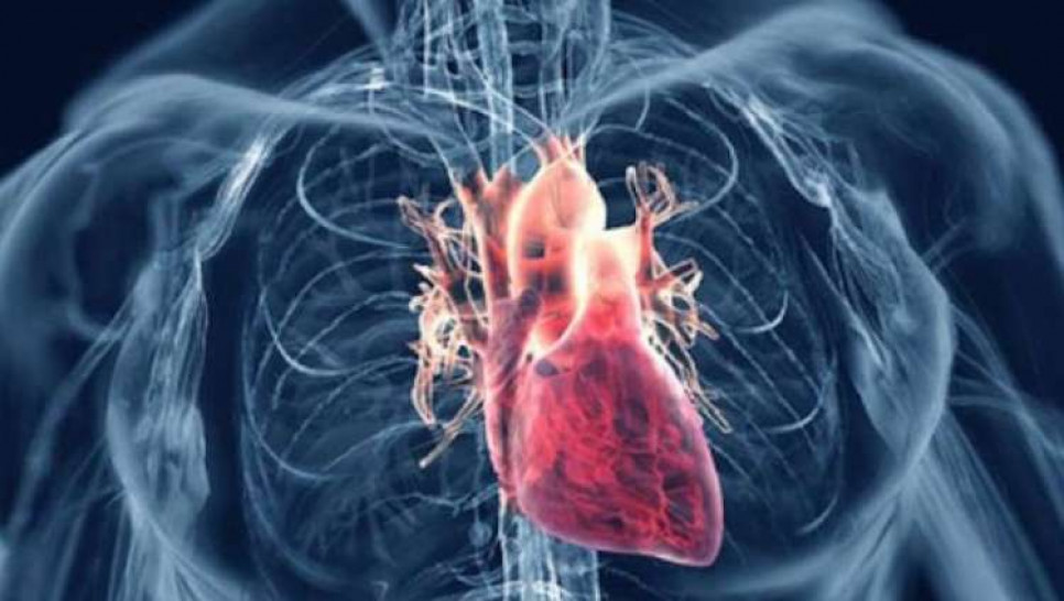 imagen Cardiopatía Isquémica para estudiantes de 5° y 6° años de Medicina