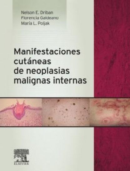 imagen Presentan el libro "Manifestaciones cutáneas de neoplasias  malignas internas"