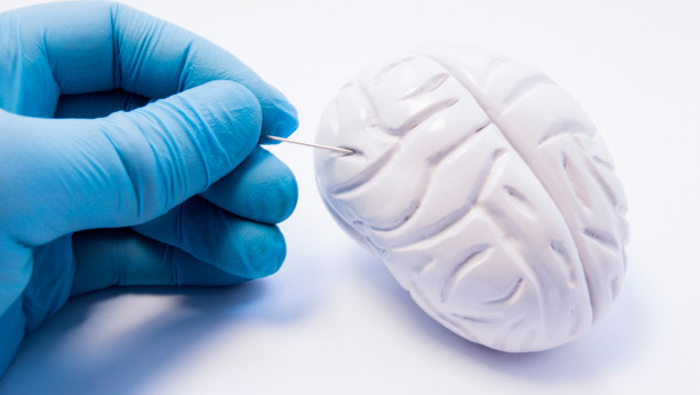 imagen Presentan nuevo modelo informático de neurocirugía estereotáctica para toma de muestras de tumores cerebrales 