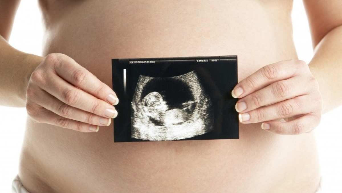 imagen Patología fetal: malformaciones torácicas