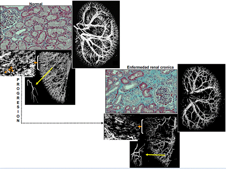 imagen Presentarán los últimos avances en angiogénesis como posible terapéutica en el paciente renal